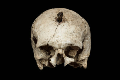 Menschlicher Schädel mit Nagel aus der Siedlung von Ullastret, © Museu d’Arqueologia de Catalunya, Barcelona